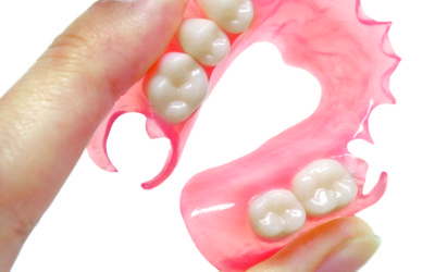 Proteza dentară elastică